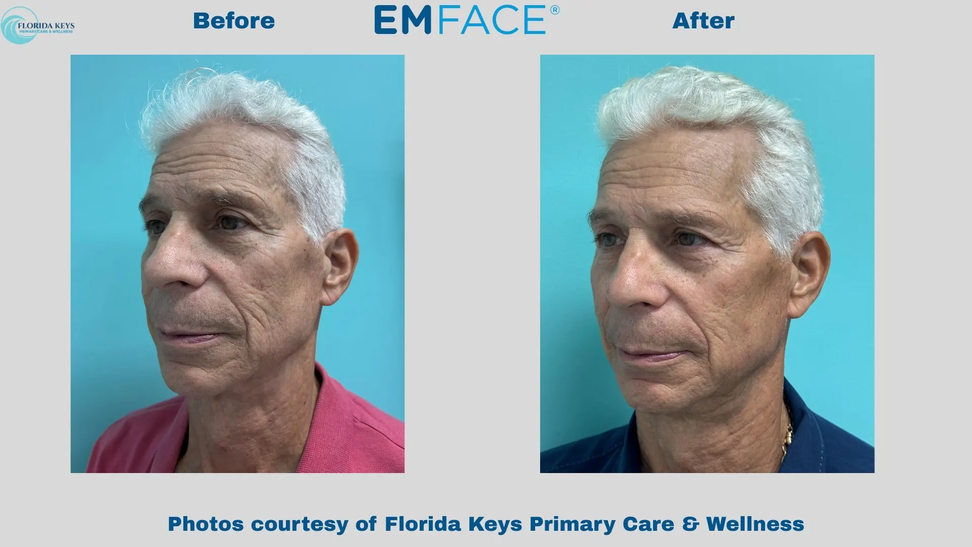 Emface in Big Pine Key, FL