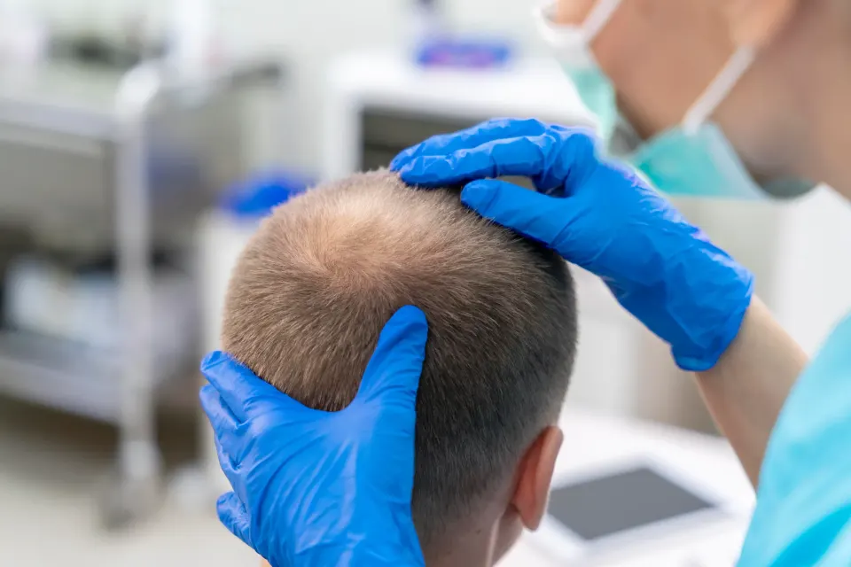 Lab tubes and clinical paperwork related to hair loss workup