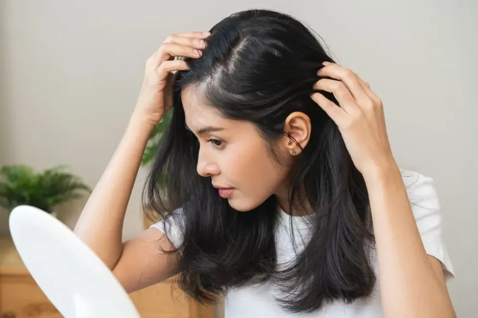 Signs You May Benefit From Hair Loss Treatment