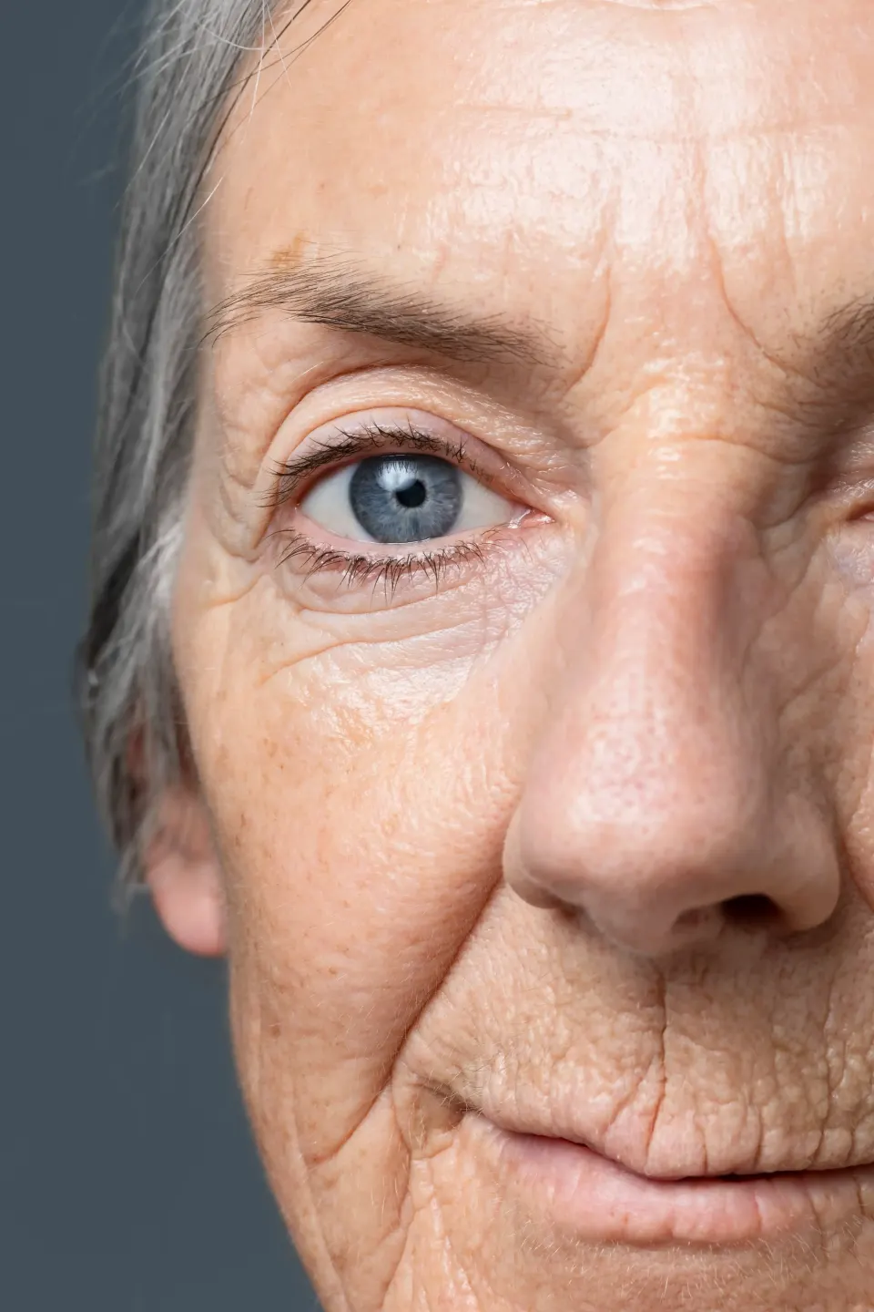 Cross-sectional illustration of dermis showing collagen and elastin