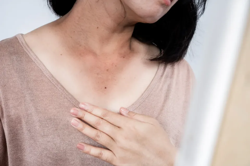Close-up of sun-damaged skin with visible pigmentation