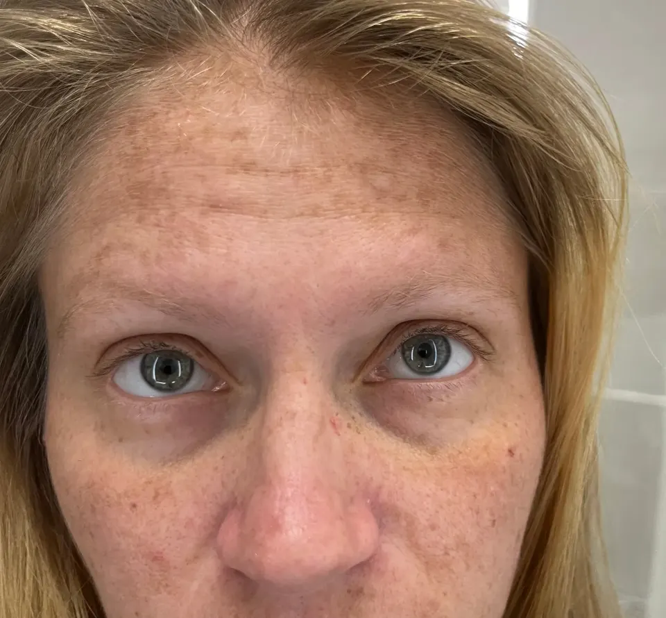 Diagnostic close-up showing different types of pigmentation