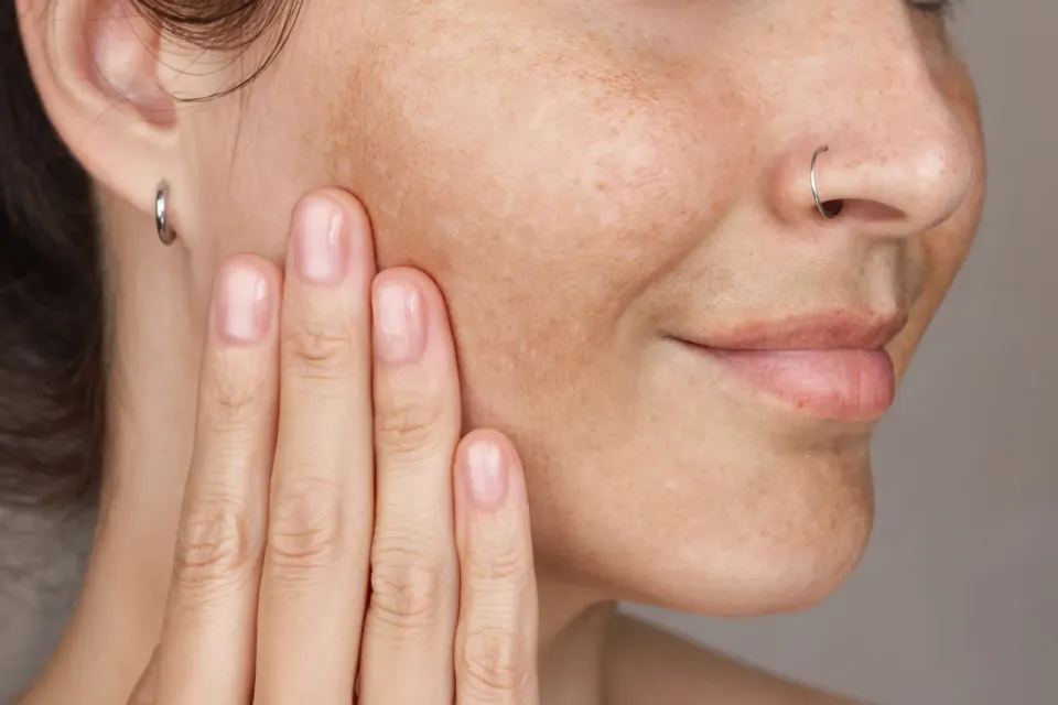 Mature woman examining sun spots and uneven pigmentation on cheek in soft natural light
