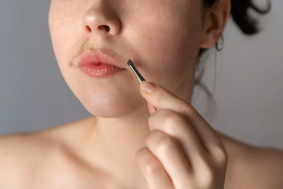 Modern Nirvana laser hair removal device in clinical setting